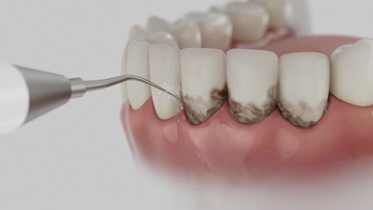 Trusted Tooth Extraction service in Baxter Springs, KS - Dentist Open Now